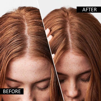 Anti-Dandruff & Anti-Itch Charcoal Detox Conditioner - Image 10